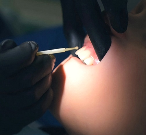 Fluoride varnish applied to teeth in Grayslake