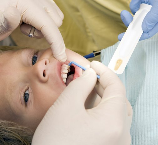 Child receiving fluoride treatment